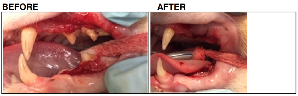 Kai before and after tooth extraction surgery